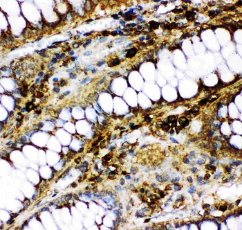 p73/TP73 Rabbit Polyclonal Antibody