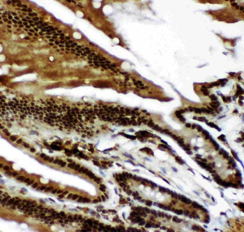 p73/TP73 Rabbit Polyclonal Antibody
