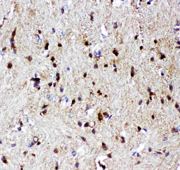 p73/TP73 Rabbit Polyclonal Antibody