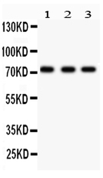 p73/TP73 Rabbit Polyclonal Antibody