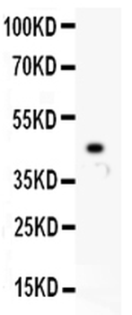 p73/TP73 Rabbit Polyclonal Antibody