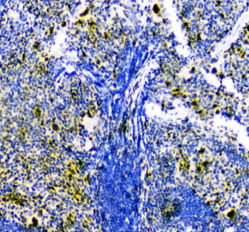 Smad Interacting Protein 1/ZEB2 Rabbit Polyclonal Antibody