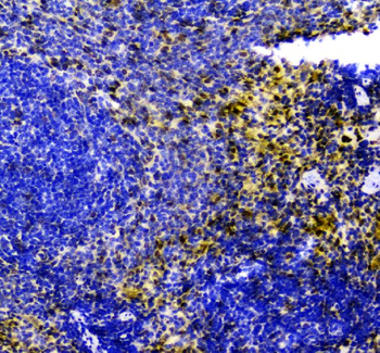 Smad Interacting Protein 1/ZEB2 Rabbit Polyclonal Antibody