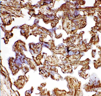 Hsp27/HSPB1 Antibody