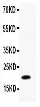 IL12 p40/IL12B Antibody