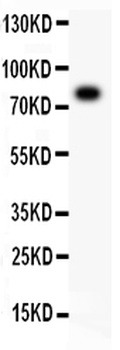 5 Lipoxygenase/ALOX5 Rabbit Polyclonal Antibody