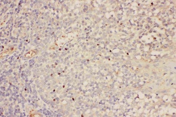 Forkhead box protein P3 FOXP3 Rabbit Polyclonal Antibody