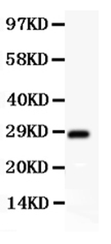 SCP3/SYCP3 Rabbit Polyclonal Antibody