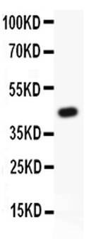 TIE2/TEK Rabbit Polyclonal Antibody