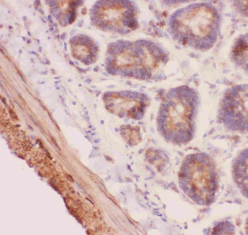 Angiopoietin 2/ANGPT2 Antibody