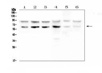 PD1/PDCD1 Antibody