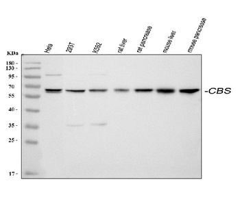 Cystathionine beta-synthase CBS Rabbit Polyclonal Antibody