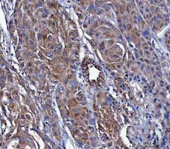 Dicer/DICER1 Antibody