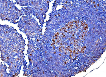 Survivin/BIRC5 Antibody
