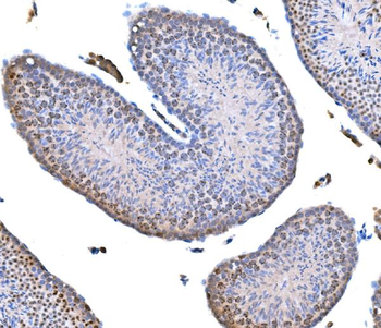 Survivin/BIRC5 Antibody