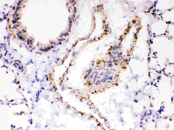 SERCA2 ATPase/ATP2A2 Rabbit Polyclonal Antibody