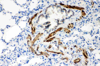 SERCA2 ATPase/ATP2A2 Rabbit Polyclonal Antibody