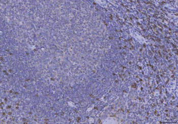 CD8 alpha/CD8A Rabbit Polyclonal Antibody