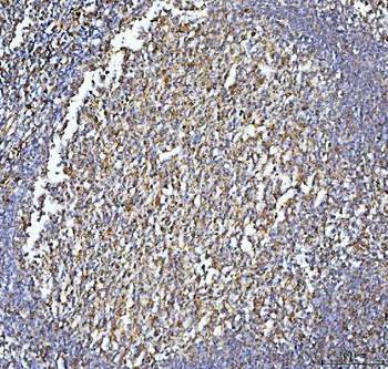 CD86 Rabbit Polyclonal Antibody