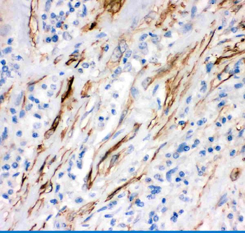 Fas Antibody
