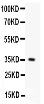 Fas Antibody