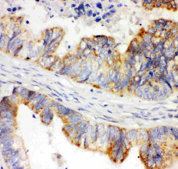 HIF-1-alpha/HIF1A Antibody
