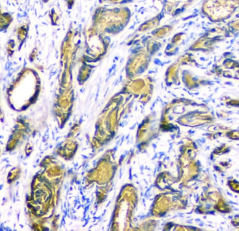 Prostate Specific Antigen/KLK3 Rabbit Polyclonal Antibody