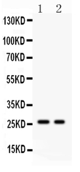 Kallikrein 4/KLK4 Rabbit Polyclonal Antibody