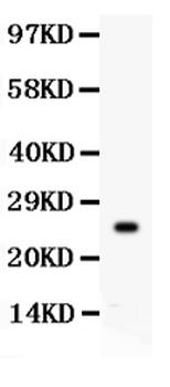 Kallikrein 4/KLK4 Rabbit Polyclonal Antibody