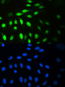 MCM7 Antibody
