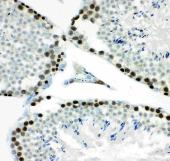 MCM7 Antibody