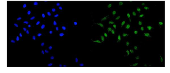 MAD1/MAD1L1 Antibody