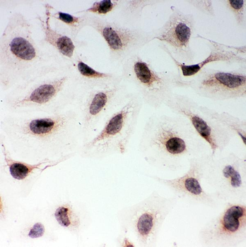 MAD1/MAD1L1 Antibody