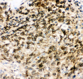 MAD1/MAD1L1 Antibody