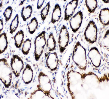 MAD1/MAD1L1 Antibody