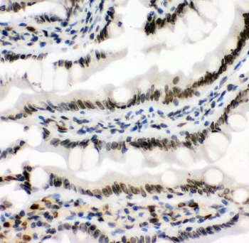 MAD1/MAD1L1 Antibody
