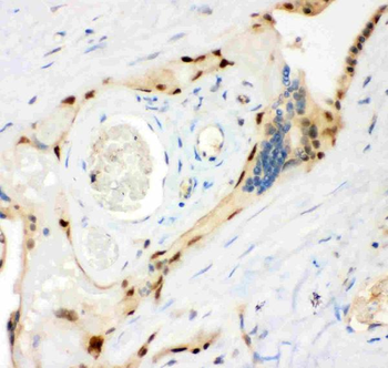 MSK1/RPS6KA5 Rabbit Polyclonal Antibody