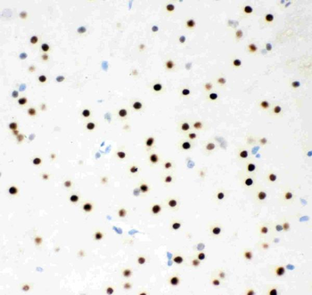 MSK1/RPS6KA5 Rabbit Polyclonal Antibody