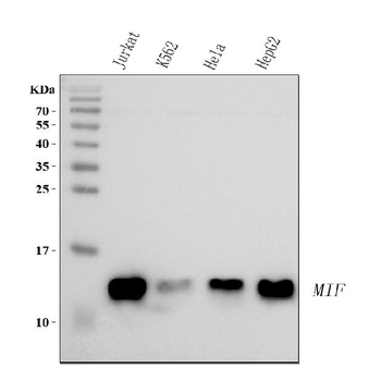 MIF Rabbit Polyclonal Antibody