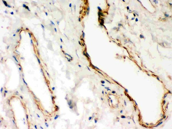 Dystrophin/DMD Rabbit Polyclonal Antibody