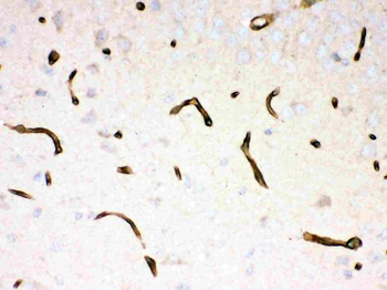 Dystrophin/DMD Rabbit Polyclonal Antibody