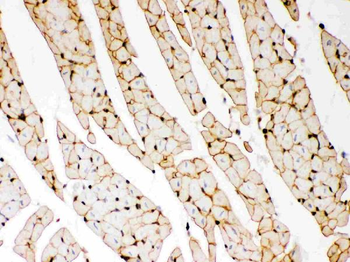 Dystrophin/DMD Rabbit Polyclonal Antibody