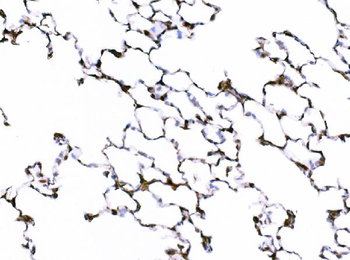 Galectin 3/LGALS3 Rabbit Polyclonal Antibody