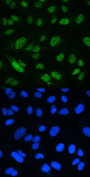 MSH2 Rabbit Polyclonal Antibody