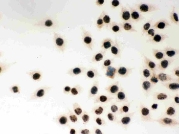 MSH2 Rabbit Polyclonal Antibody