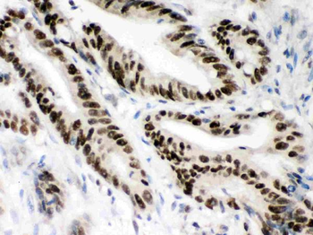 MSH2 Rabbit Polyclonal Antibody