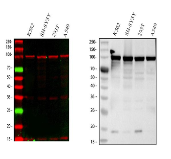 MSH2 Rabbit Polyclonal Antibody