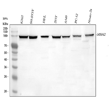 MSH2 Rabbit Polyclonal Antibody
