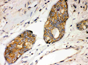 IKB alpha/NFKBIA Rabbit Polyclonal Antibody