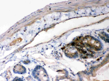 IKB alpha/NFKBIA Rabbit Polyclonal Antibody